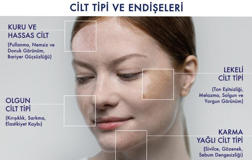 CİLT TİPİ VE ENDİŞELERİ