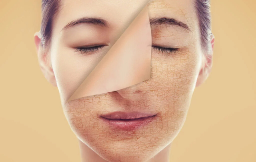 İhmal Edilmiş Ciltler İçin Toparlayıcı Bakım Rehberi