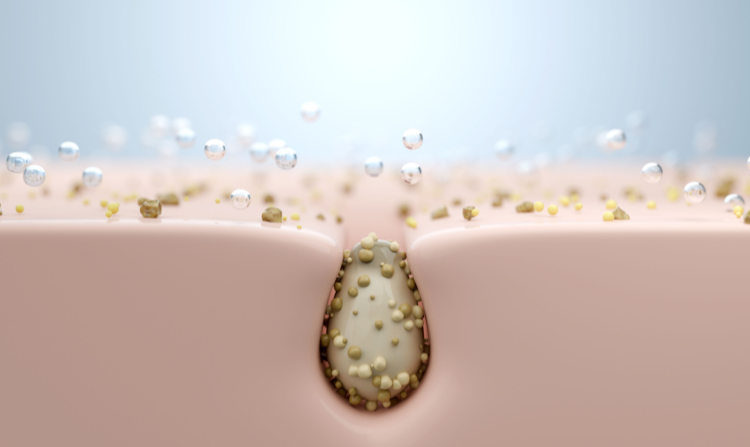 Sebum Nedir? Sebum Nasıl Dengelenir?